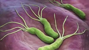 被美国卫生部列入新版“致癌物清单”，幽门螺旋杆菌究竟该怎么防？