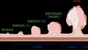 扬州市邗江区结直肠癌筛查民生工程白皮书发布